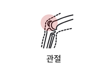 관절